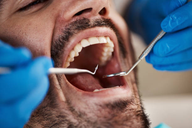 Best After-Hours Dental Trauma Care in Ontonagon, MI